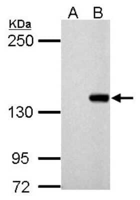 Western Blot: DNMT3B Antibody [NBP2-16206]