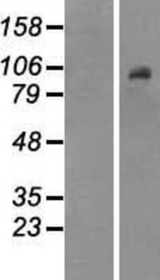 Western Blot: DNMT3B Overexpression Lysate [NBP2-07562]