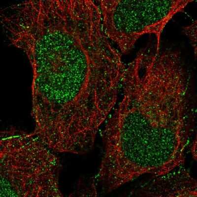 Immunocytochemistry/ Immunofluorescence: Doc2-alpha Antibody [NBP2-55903]