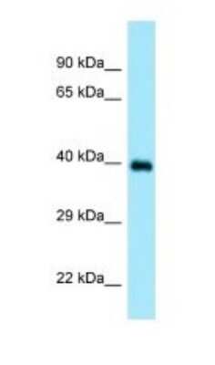 Western Blot: Doc2-alpha Antibody [NBP1-98544]