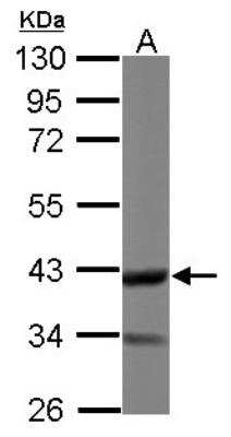 Western Blot: Doc2-alpha Antibody [NBP2-16209]