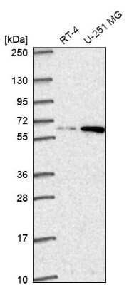 Western Blot: Dolichol Kinase Antibody [NBP2-68873]