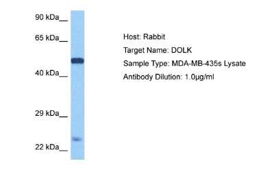 Western Blot: Dolichol Kinase Antibody [NBP2-84813]