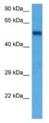 Western Blot: Dolichol Kinase Antibody [NBP3-10981]