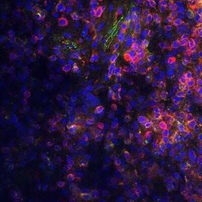 Immunocytochemistry/ Immunofluorescence: Donkey anti-Goat IgG (H+L) Secondary Antibody (Pre-adsorbed) [NBP2-60657]