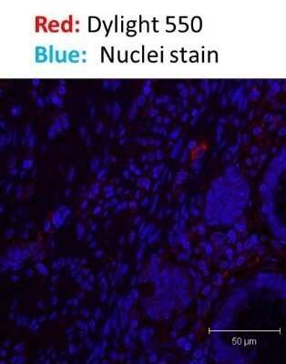 Immunohistochemistry: Donkey anti-Rabbit IgG (H+L) Secondary Antibody (Pre-adsorbed) [NBP1-75279]