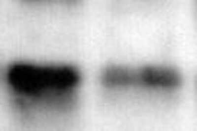 Western Blot: Donkey anti-Rabbit IgG (H+L) Secondary Antibody (Pre-adsorbed) [NBP1-75286]