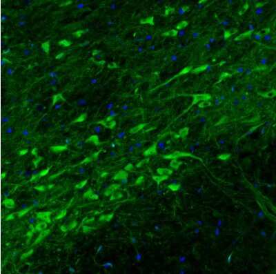 Immunohistochemistry: Dopa Decarboxylase/DDC Antibody (CL2962) [NBP2-46642]