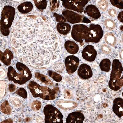 Immunohistochemistry-Paraffin: Dopa Decarboxylase/DDC Antibody (CL2962) [NBP2-46642]