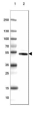Western Blot: Dopa Decarboxylase/DDC Antibody (CL2962) [NBP2-46642]