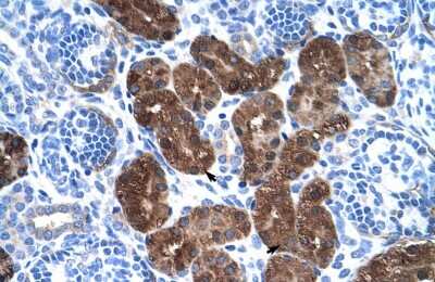 Immunohistochemistry-Paraffin: Dopa Decarboxylase/DDC Antibody [NBP1-56918]