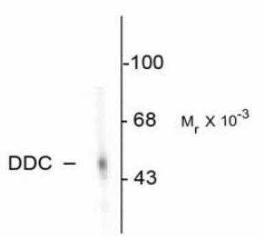 Western Blot: Dopa Decarboxylase/DDC Antibody [NB300-174]