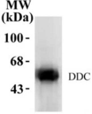 Western Blot: Dopa Decarboxylase/DDC Antibody [NB300-174]