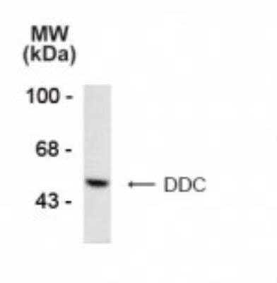 Western Blot: Dopa Decarboxylase/DDC Antibody [NB300-252]