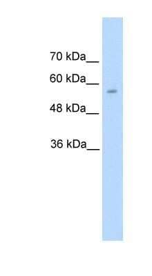 Western Blot: Dopa Decarboxylase/DDC Antibody [NBP1-56918]