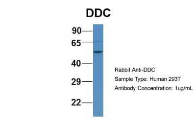 Western Blot: Dopa Decarboxylase/DDC Antibody [NBP1-56918]