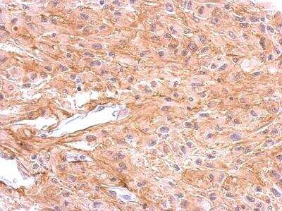 Immunohistochemistry-Paraffin: Dopamine D1R/DRD1 Antibody [NBP2-16213]