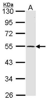 Western Blot: Dopamine D1R/DRD1 Antibody [NBP2-16213]