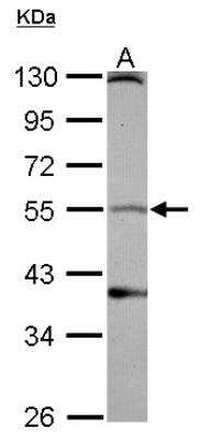 Western Blot: Dopamine D1R/DRD1 Antibody [NBP2-16214]