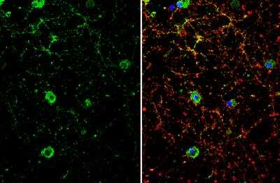 Immunocytochemistry/ Immunofluorescence: Dopamine D1R/DRD1 Antibody [NBP2-16213]