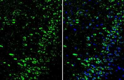 Immunohistochemistry-Frozen: Dopamine D1R/DRD1 Antibody [NBP2-16213]