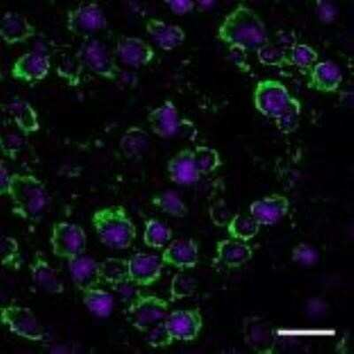 Immunocytochemistry: Dopamine D1R/DRD1 Antibody (SG2-D1a) - Azide and BSA Free [NBP2-80700]