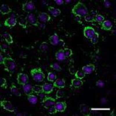 Immunohistochemistry: Dopamine D1R/DRD1 Antibody (SG2-D1a) [NB110-60017]