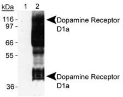 Western Blot: Dopamine D1R/DRD1 Antibody (SG2-D1a) [NB110-60017]