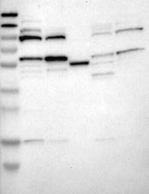 Western Blot: Dopamine D1R/DRD1 Antibody [NBP3-17644]