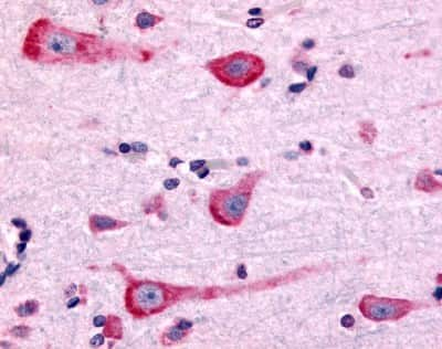 Immunohistochemistry-Paraffin: Dopamine D2R/DRD2 Antibody - BSA Free [NLS1403]