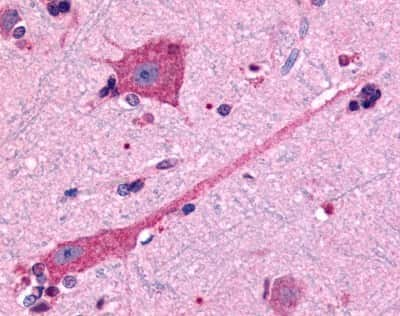 Immunohistochemistry-Paraffin: Dopamine D2R/DRD2 Antibody - BSA Free [NLS1405]