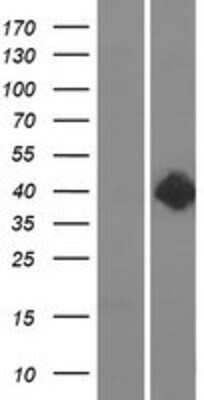 Western Blot: Dopamine D2R/DRD2 Overexpression Lysate [NBP2-07013]