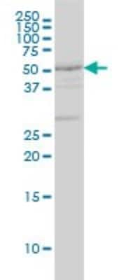 Western Blot: Dopamine D2R/DRD2 Antibody (1B11) [H00001813-M01A]