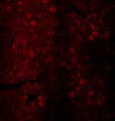 Immunohistochemistry: Dopamine D2R/DRD2 Antibody [NBP2-88996]