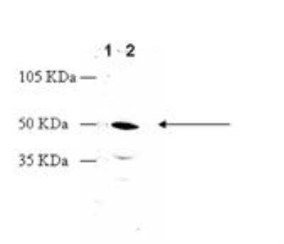 Western Blot: Dopamine D2R/DRD2 Antibody [NBP2-88996]