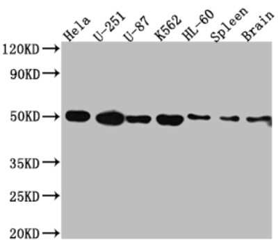 Western Blot: Dopamine D3R/DRD3 Antibody (5B10) [NBP3-15187]