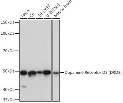 Western Blot: Dopamine D3R/DRD3 Antibody (5L1P4) [NBP3-16443]