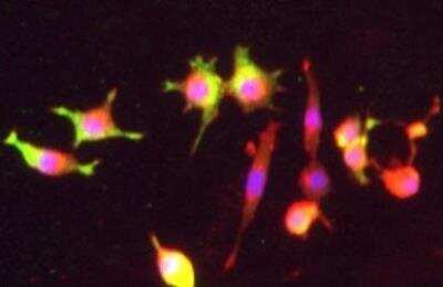 Immunocytochemistry/ Immunofluorescence: Dopamine D3R/DRD3 Antibody [NBP3-12391]