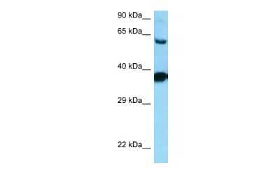 Western Blot: Dopamine D3R/DRD3 Antibody [NBP2-84009]