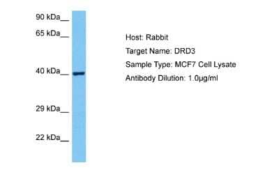 Western Blot: Dopamine D3R/DRD3 Antibody [NBP2-84011]