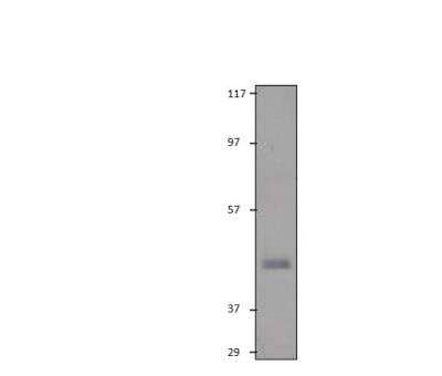 Western Blot: Dopamine D3R/DRD3 Antibody [NBP3-12391]