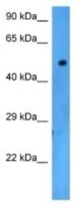 Western Blot: Dopamine D5R/DRD5 Antibody [NBP3-10782]