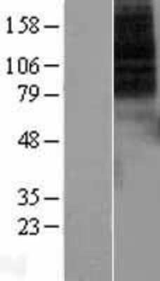 Western Blot: Dopamine D1R/DRD1 Overexpression Lysate [NBL1-10015]