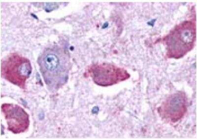 Immunohistochemistry-Paraffin: Dopamine Receptor D4 Antibody [NBP3-12210]