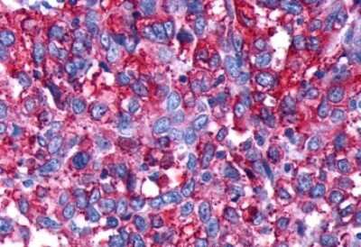 Immunohistochemistry-Paraffin: Dopamine Receptor D4 Antibody - BSA Free [NLS3921]