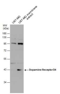 Western Blot: Dopamine Receptor D4 Antibody [NBP3-13064]