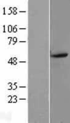 Western Blot: Dopamine D5R/DRD5 Overexpression Lysate [NBL1-10019]