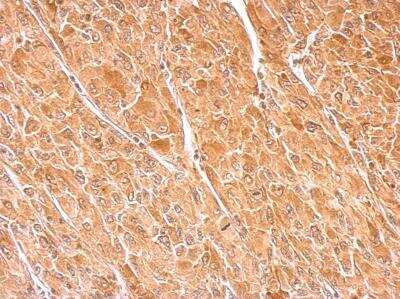 Immunohistochemistry-Paraffin: Dopamine beta-Hydroxylase Antibody [NBP1-31386]