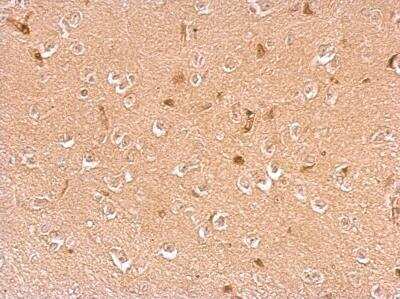 Immunohistochemistry-Paraffin: Dopamine beta-Hydroxylase Antibody [NBP1-31386]