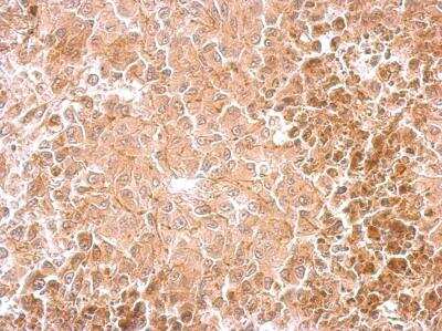 Immunohistochemistry-Paraffin: Dopamine beta-Hydroxylase Antibody [NBP1-31386]